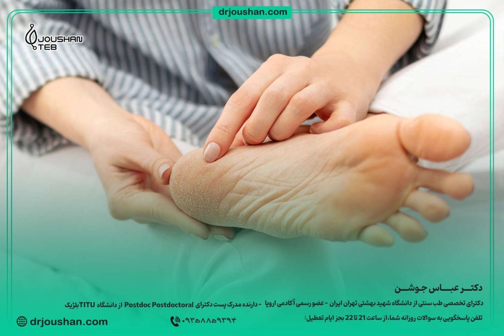 درمان-ترک-و-پوست-پوسته-شدن-پا-دکتر-عباس-جوشن