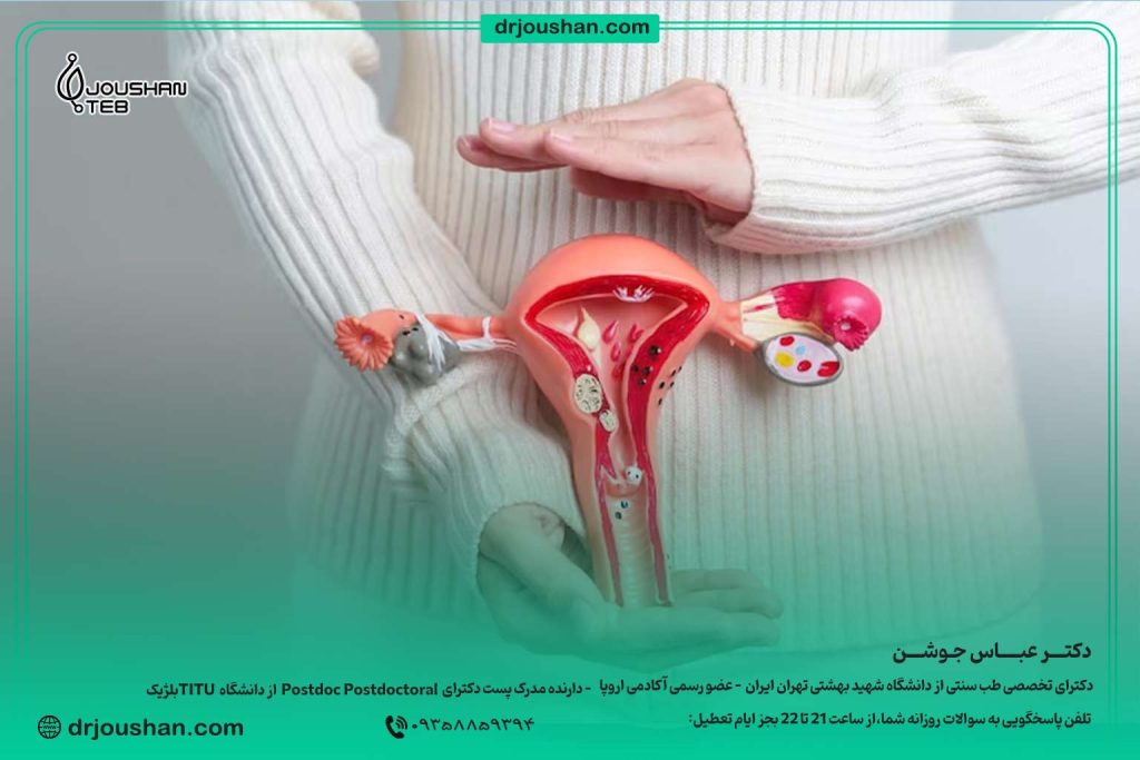 درمان-خونریزی-رحمی-غیر-طبیعی-دکتر-عباس-جوشن