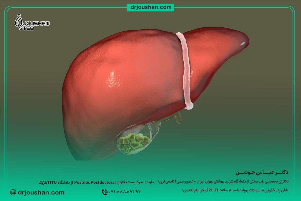 رژیم-غذایی-دفع-کننده-سنگ-صفرا--دکتر-عباس-جوشن