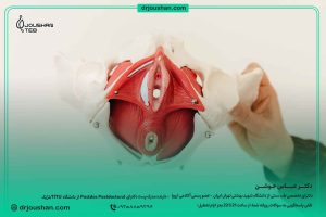 تقویت-عضلات-کف-لگن-درمان-بی-اختیاری-ادرار-مثانه-دکتر-عباس-جوشن