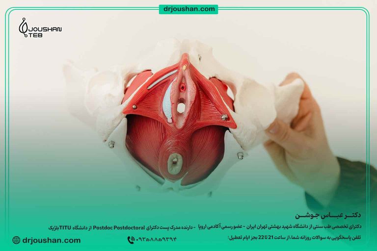 تقویت-عضلات-کف-لگن-درمان-بی-اختیاری-ادرار-مثانه-دکتر-عباس-جوشن