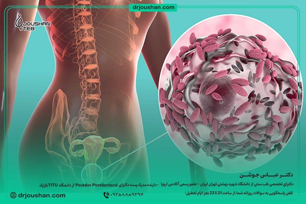 درمان-عفونت-واژن-در-خانه-دکتر-عباس-جوشن