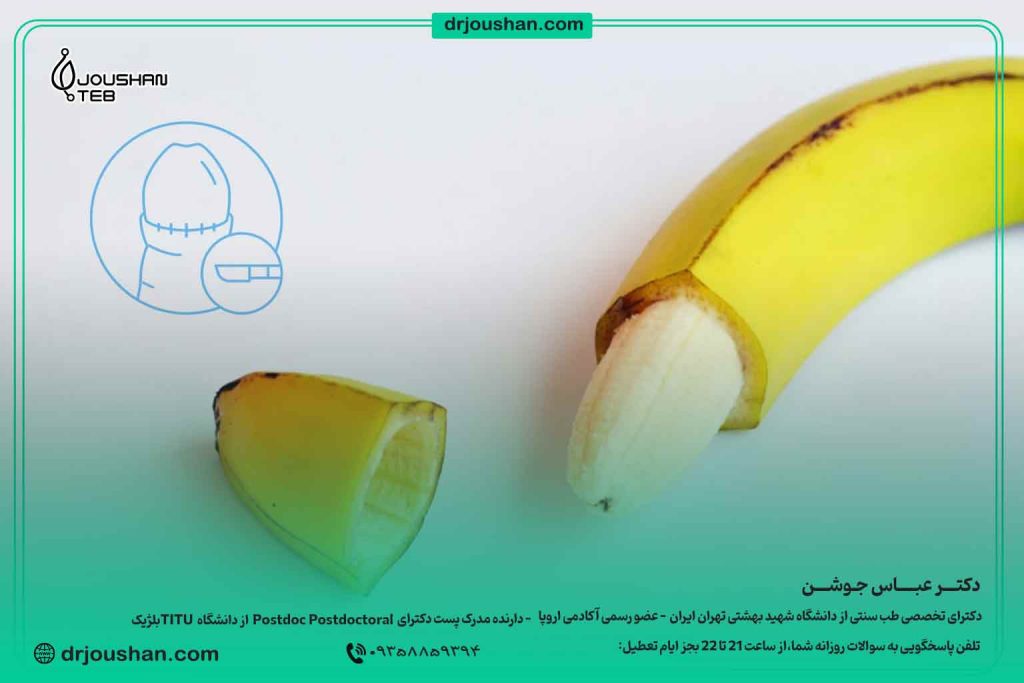 مراقبت-های-قبل-و-بعد-از-ختنه-دکتر-عباس-جوشن