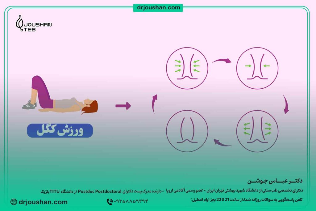 ورزش-کگل-تقویت-مثانه-دکتر-عباس-جوشن