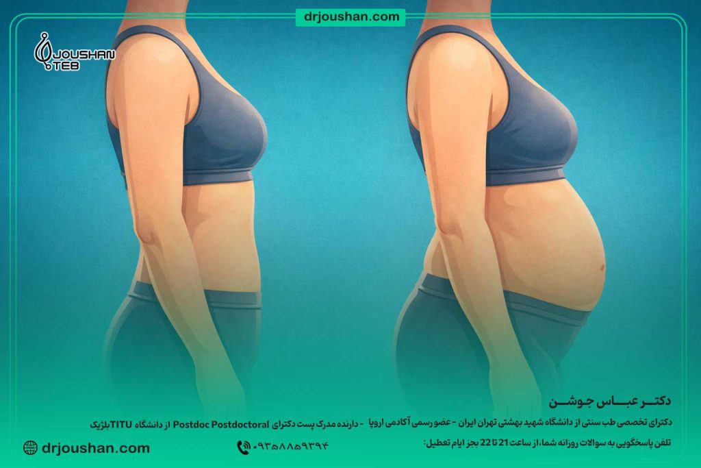 آب-کردن-چربی-شکم-در-کوتیزول-بالا-دکتر-عباس-جوشن