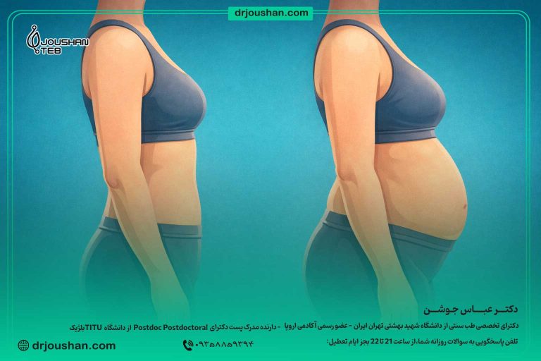 آب-کردن-چربی-شکم-در-کوتیزول-بالا-دکتر-عباس-جوشن