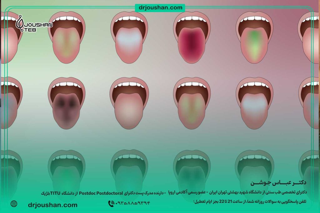آموزش-تشخیص-بیماری-ها-از-روی-زبان-در-طب-سنتی-دکتر-عباس-جوشن