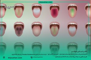 آموزش-تشخیص-بیماری-ها-از-روی-زبان-در-طب-سنتی-دکتر-عباس-جوشن