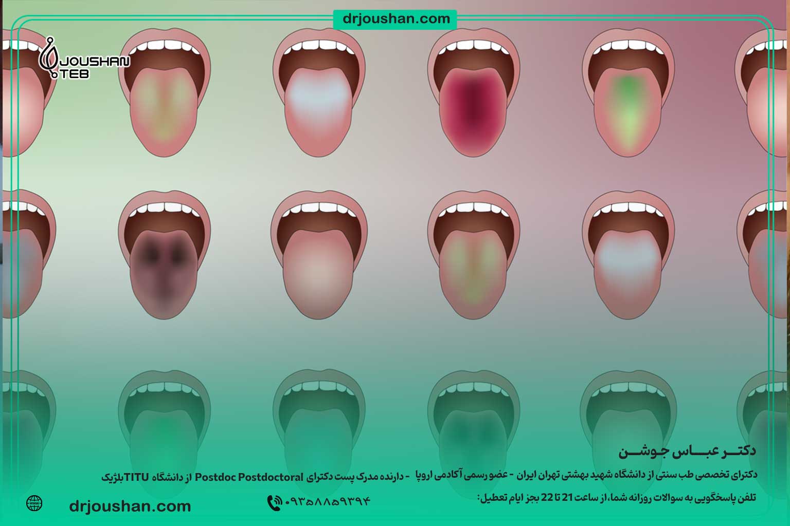 آموزش-تشخیص-بیماری-ها-از-روی-زبان-در-طب-سنتی-دکتر-عباس-جوشن