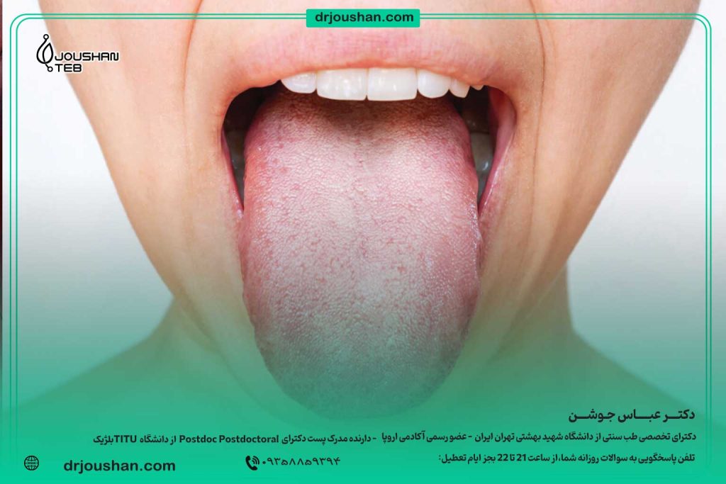 آموزش-ساده-تشخیص-بیماری-از-روی-زبان-در-طب-سنتی-دکتر-عباس-جوشن