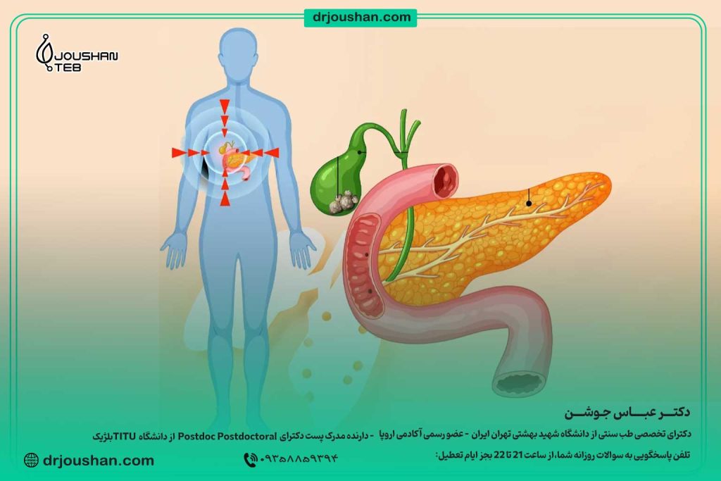 بعد-از-عمل-سنگ-صفرا-چه-کار-کنیم؟