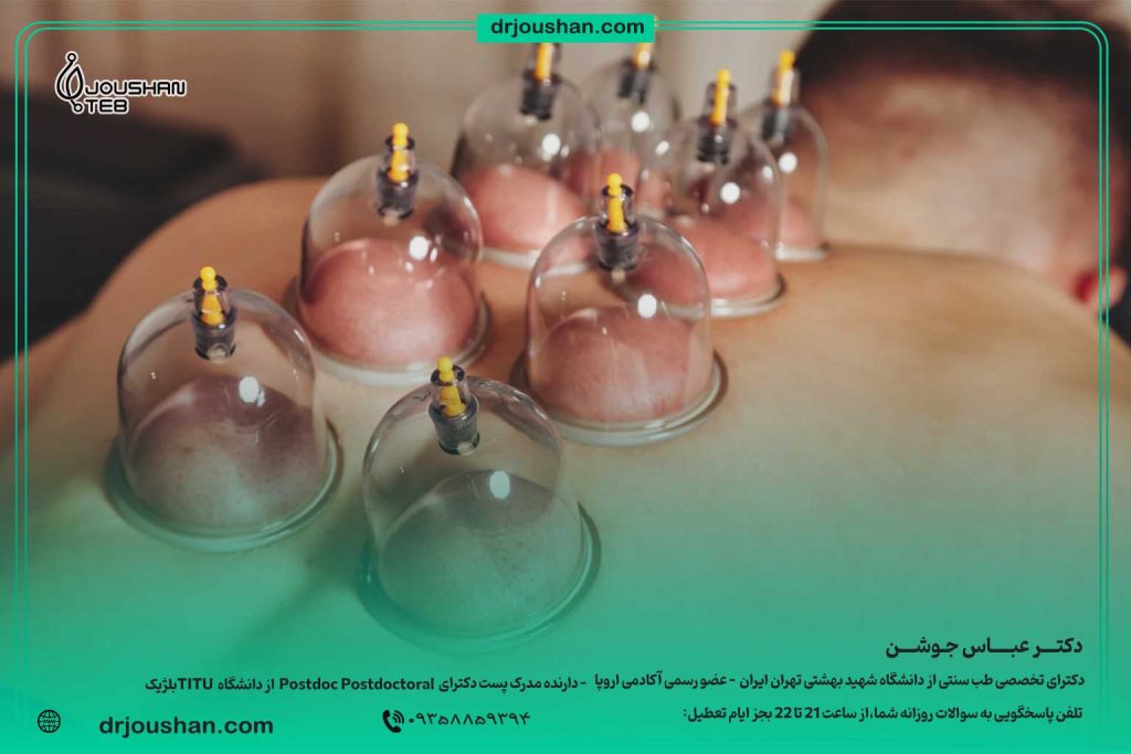 تاثیر-حچامت-بر-بدن-دکتر-عباس-جوشن
