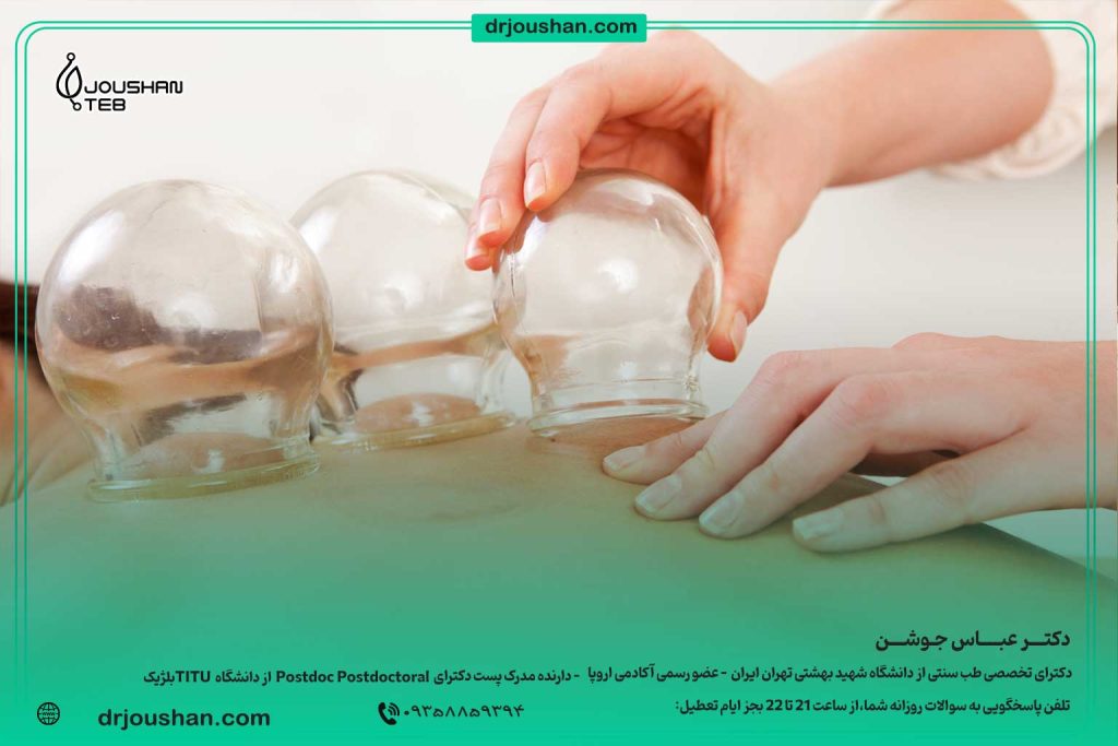 حجامت-و-فواید-آن-دکتر-عباس-جوشن