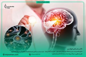 درمان-علائم-خشکی-مغز-دکتر-عباس-جوشن