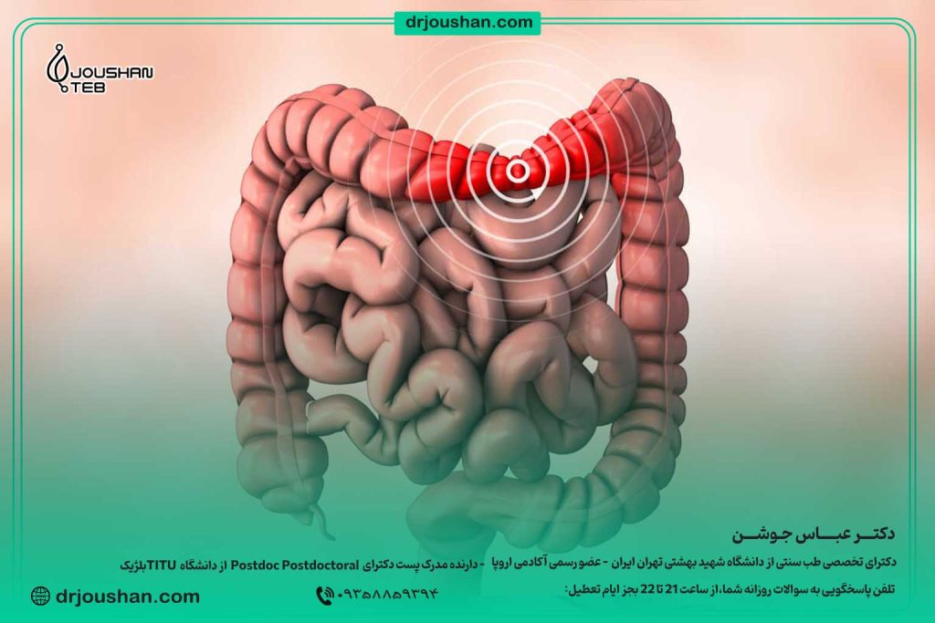 درمان-معده-و-روده-عصبی-در-طب-سنتی-دکتر-عباس-جوشن