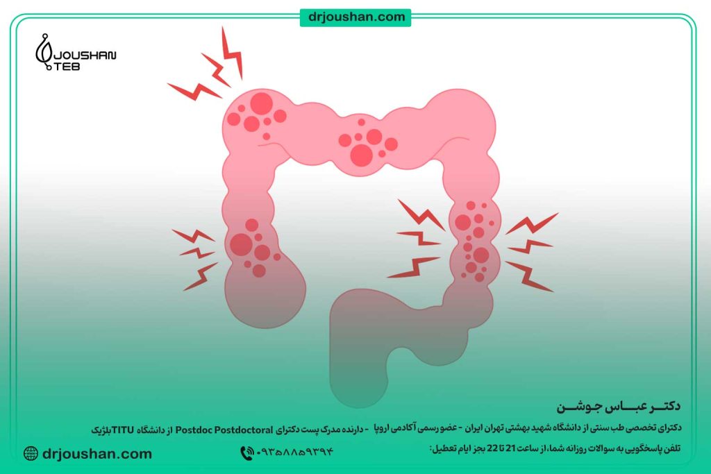 راهنمای-کامل-درمان-معده-و-روده-عصبی-دکتر-عباس-جوشن