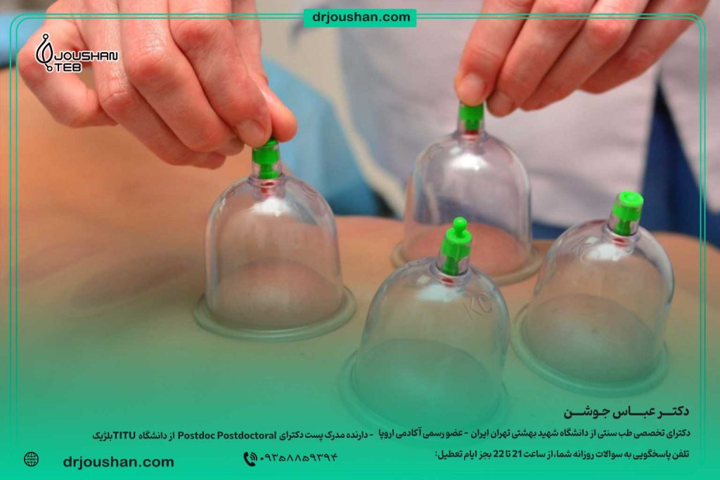 فواید-حجامت-و-برای-چه-کسانی-ضرر-دارد؟-دکتر-عباس-جوشن