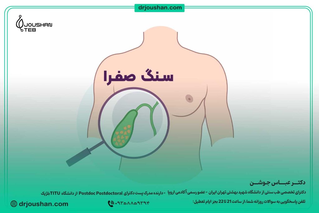 مراقبت-های-پس-از-عمل-سنگ-صفرا-دکتر-عباس-جوشن