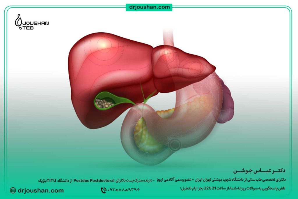 مراقبت‌های-عمومی-بعد-از-عمل-سنگ-صفرا-دکنر-عباس-جوشن