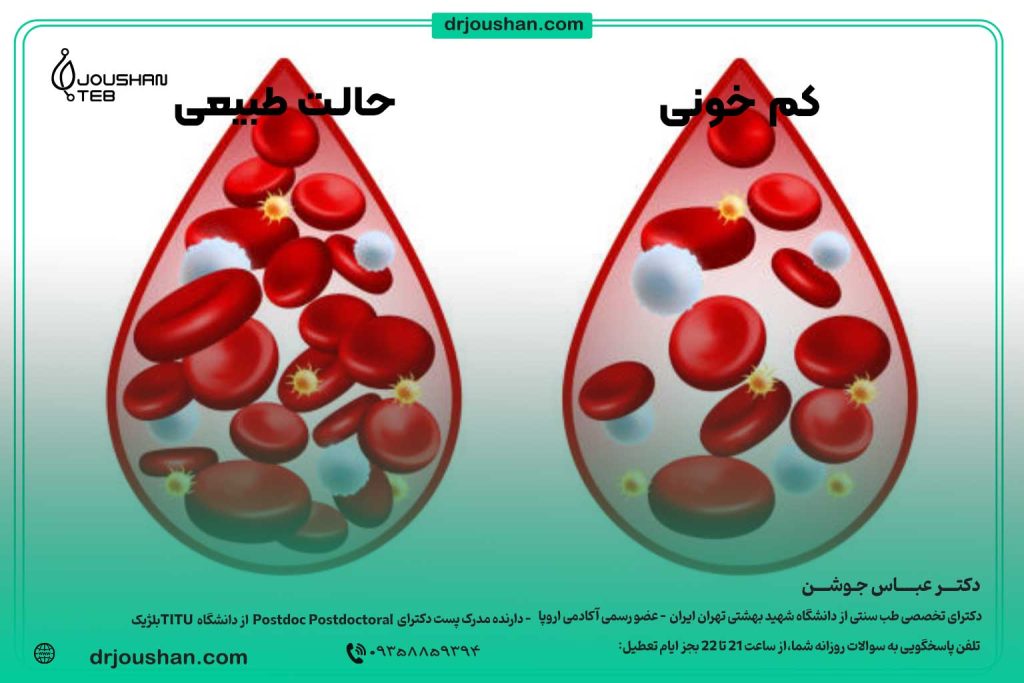 کم-خونی-و-علائم-آن-و-درمان-آن-دکتر-عباس-جوشن